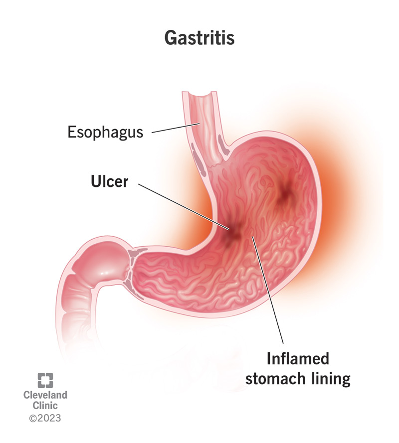 Digestive