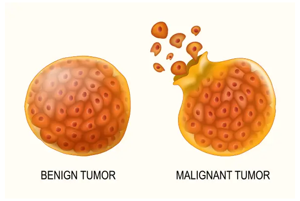 Digestive
